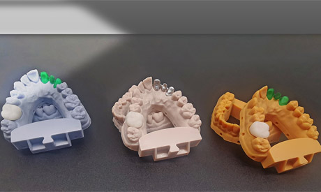 R3pro齿科3D打印机在临时牙冠领域的广泛应用