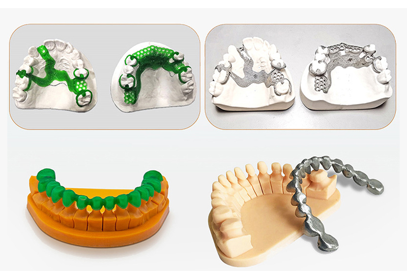 哈工三维 8K 10.1寸齿科3D打印助力牙科铸造领域数字化升级